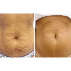 Crepe Gone Facial Souffle Anti-Aging Skin Cream