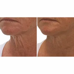 Crepe Gone Facial Souffle Anti-Aging Skin Cream