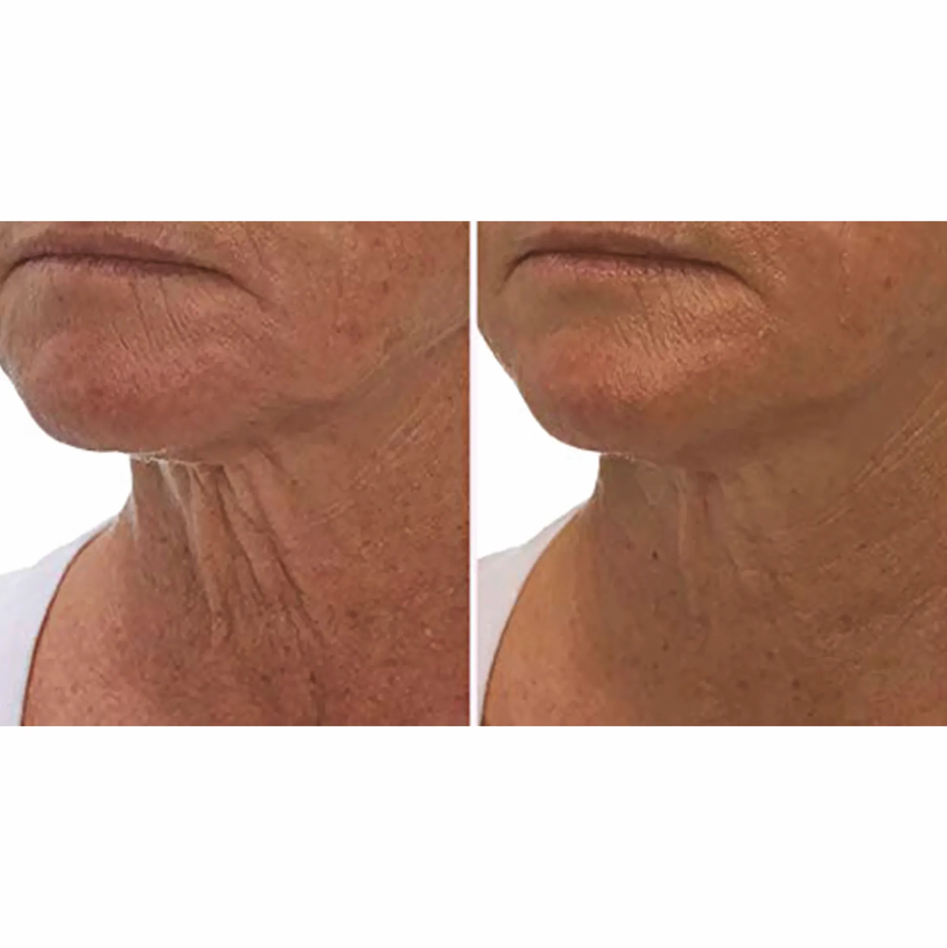 Crepe Gone Facial Souffle Anti-Aging Skin Cream