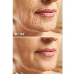 Fat Freezer Neck Firming Cream with Natural Ingredients