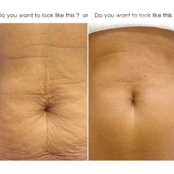IGIÁ Crepe Gone Skin Firming Stretch Mark Cream