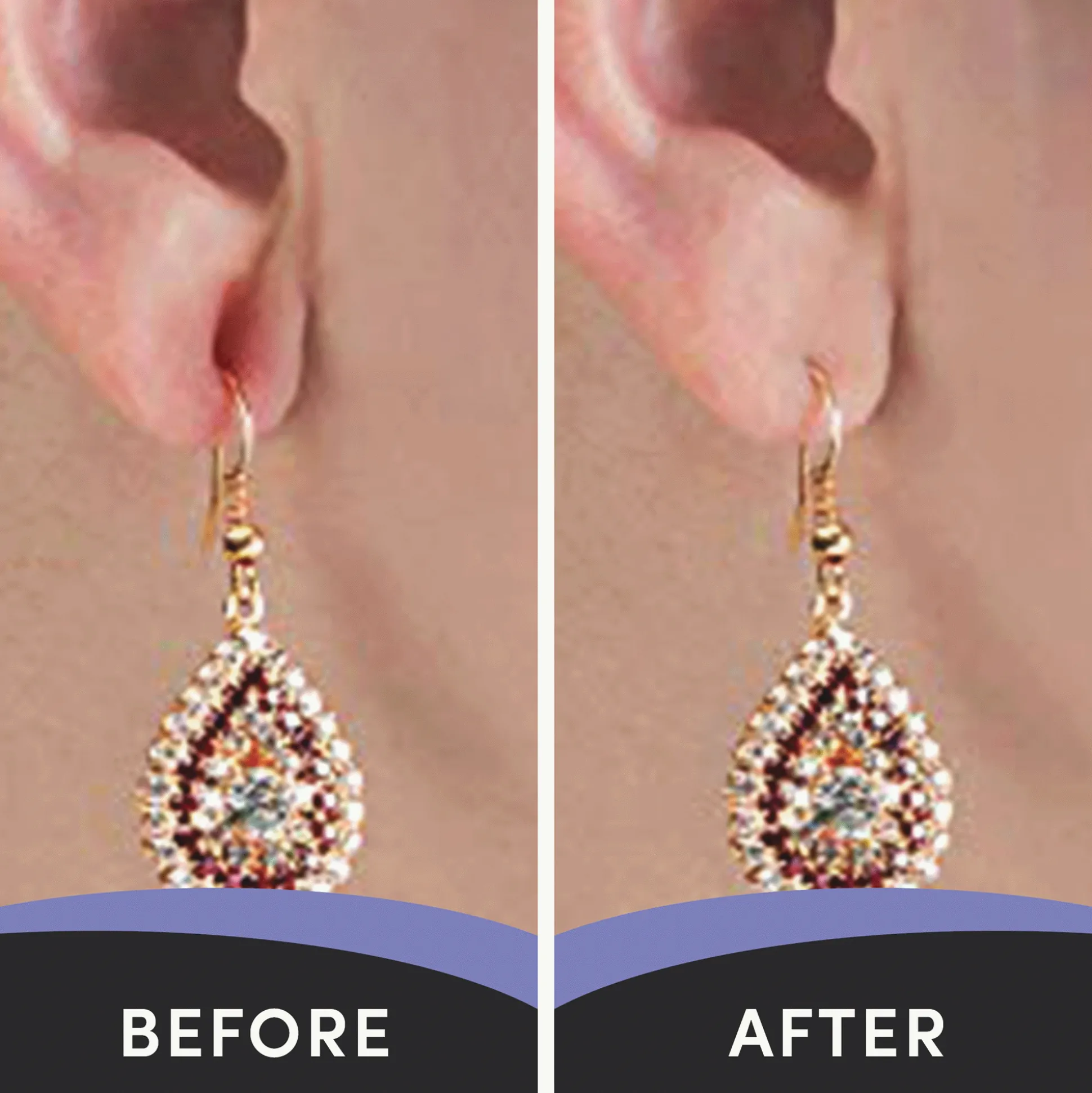 Lobe Miracle