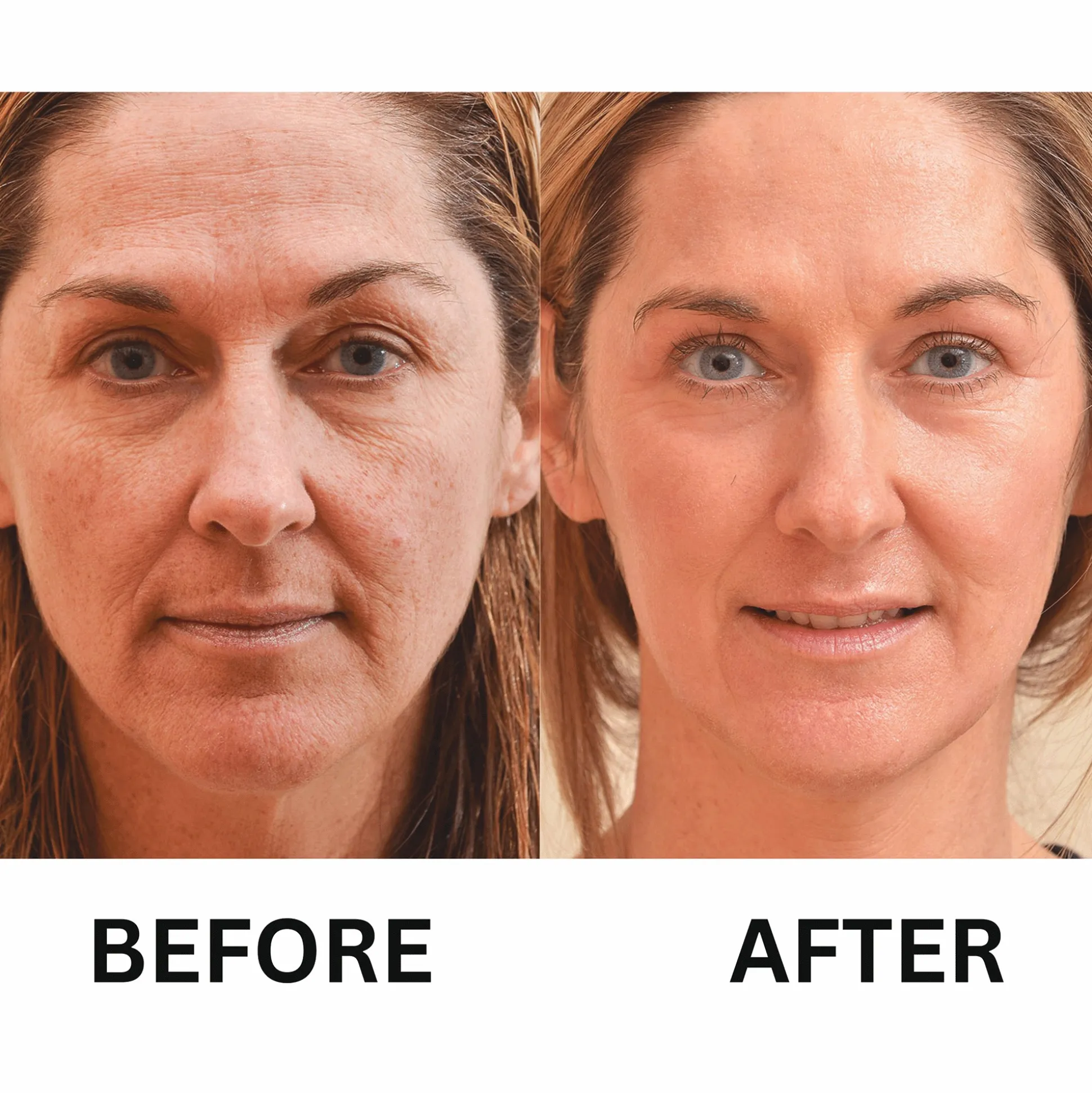 Retinol Wrinkle Miracle